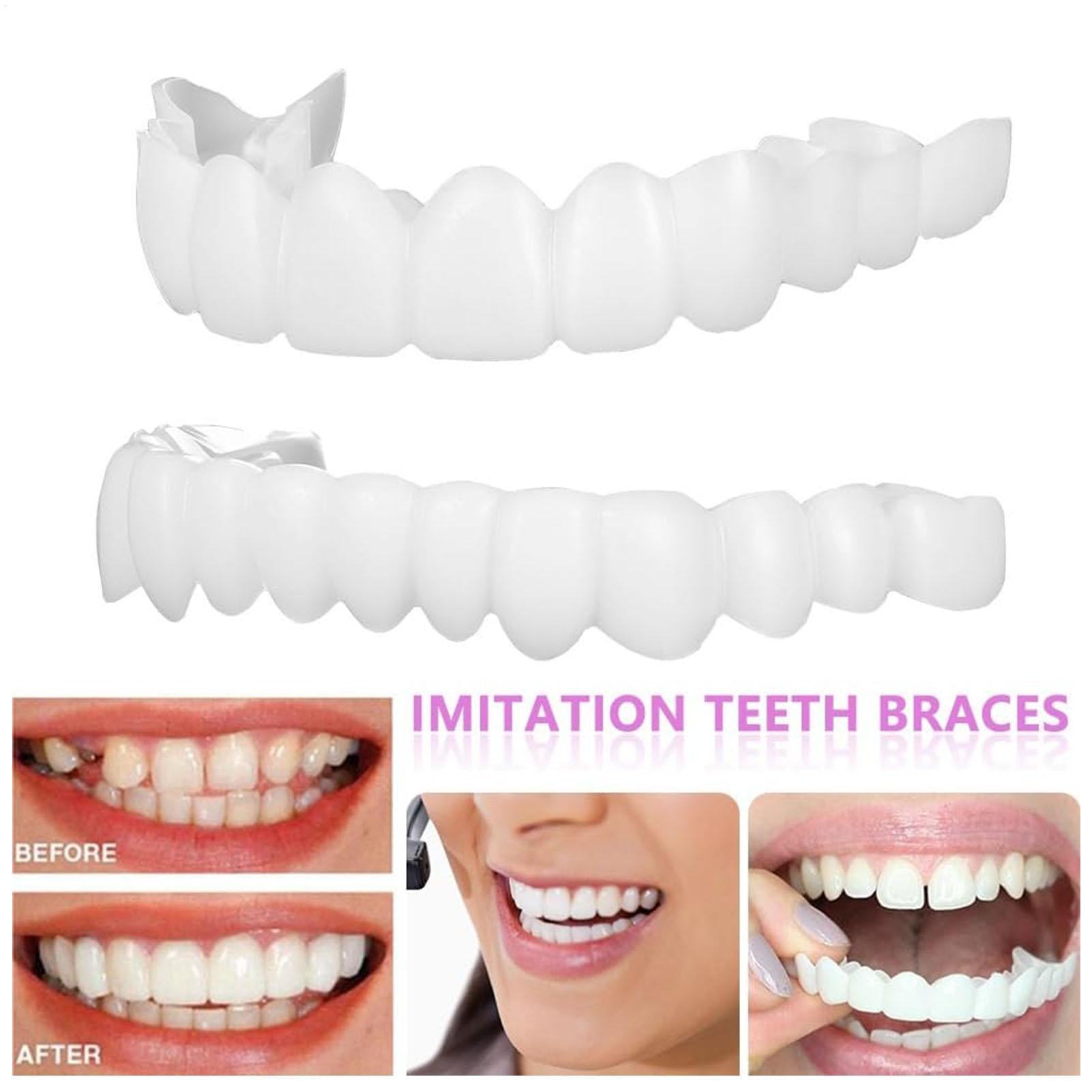 Teeth Whitening For Braces - 歯科用上下義歯カバー ブライトベニア 快適フィット フレックスデンチャー ブレース ホワイトニング交換用