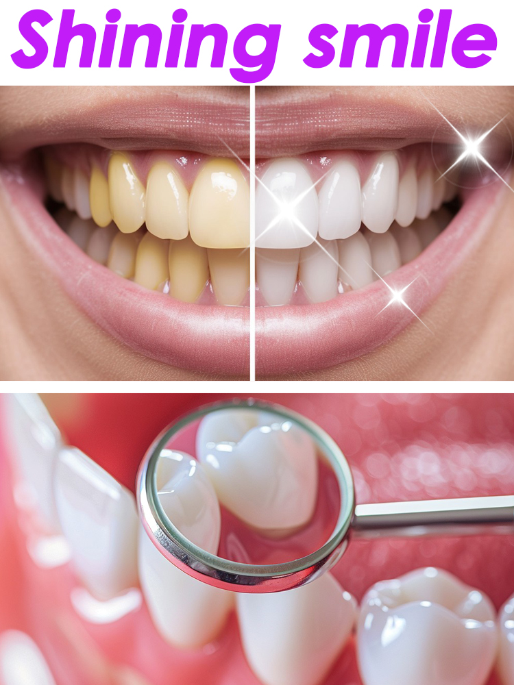 Teeth Whitening Xylitol - グローリースマイル ホワイトニング フルーティー歯磨き粉 デンタルプラグ歯石フッ素症除去 歯の虫歯予防 オーラルケア
