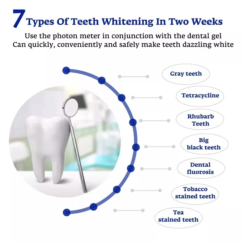 インテリジェントLEDブルーライトポータブルUSB/iPho - Teeth Whitening For Trays のレビューと価格