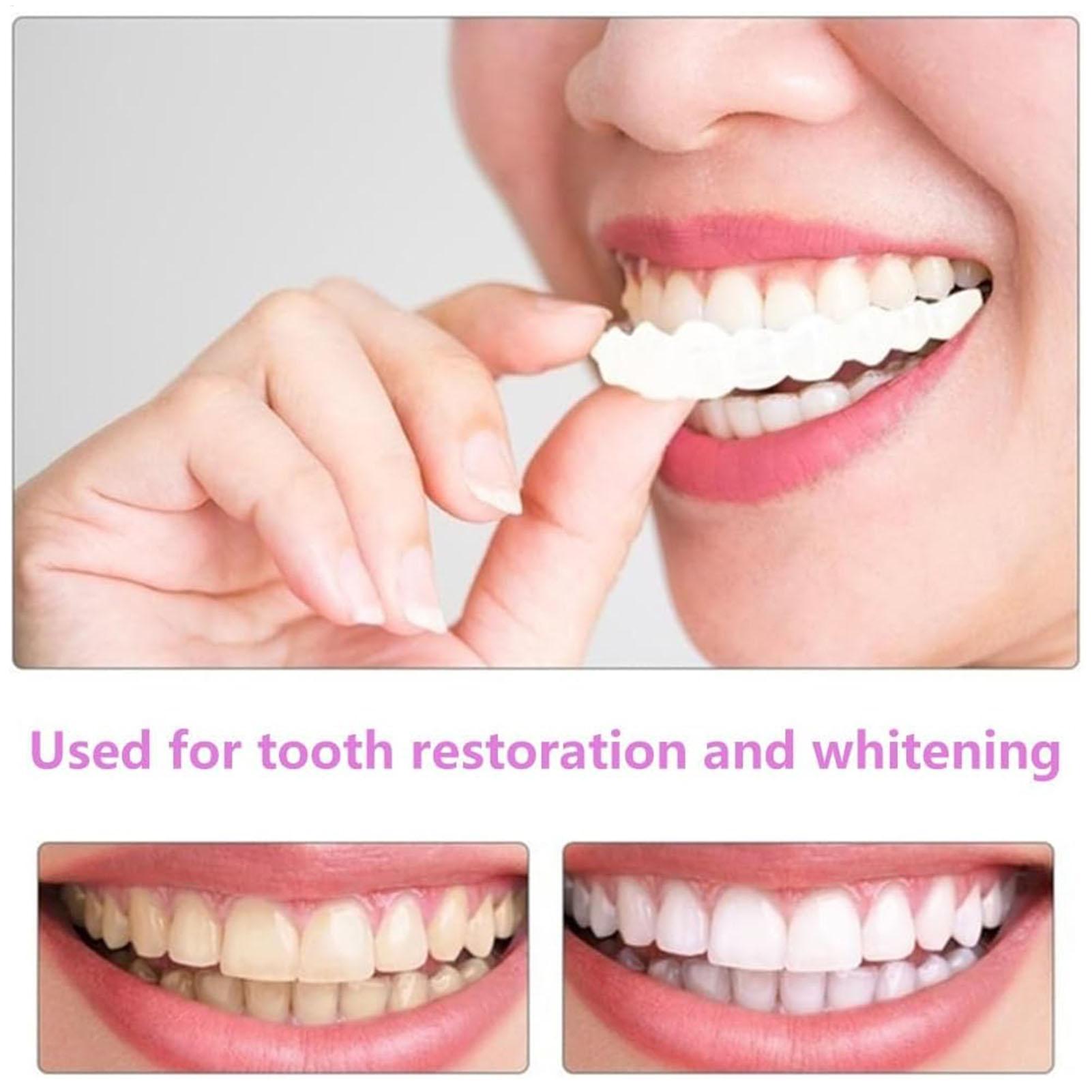 歯科用上下義歯カバー ブライトベニア 快適フィット フレック - Teeth Whitening For Braces のレビューと価格