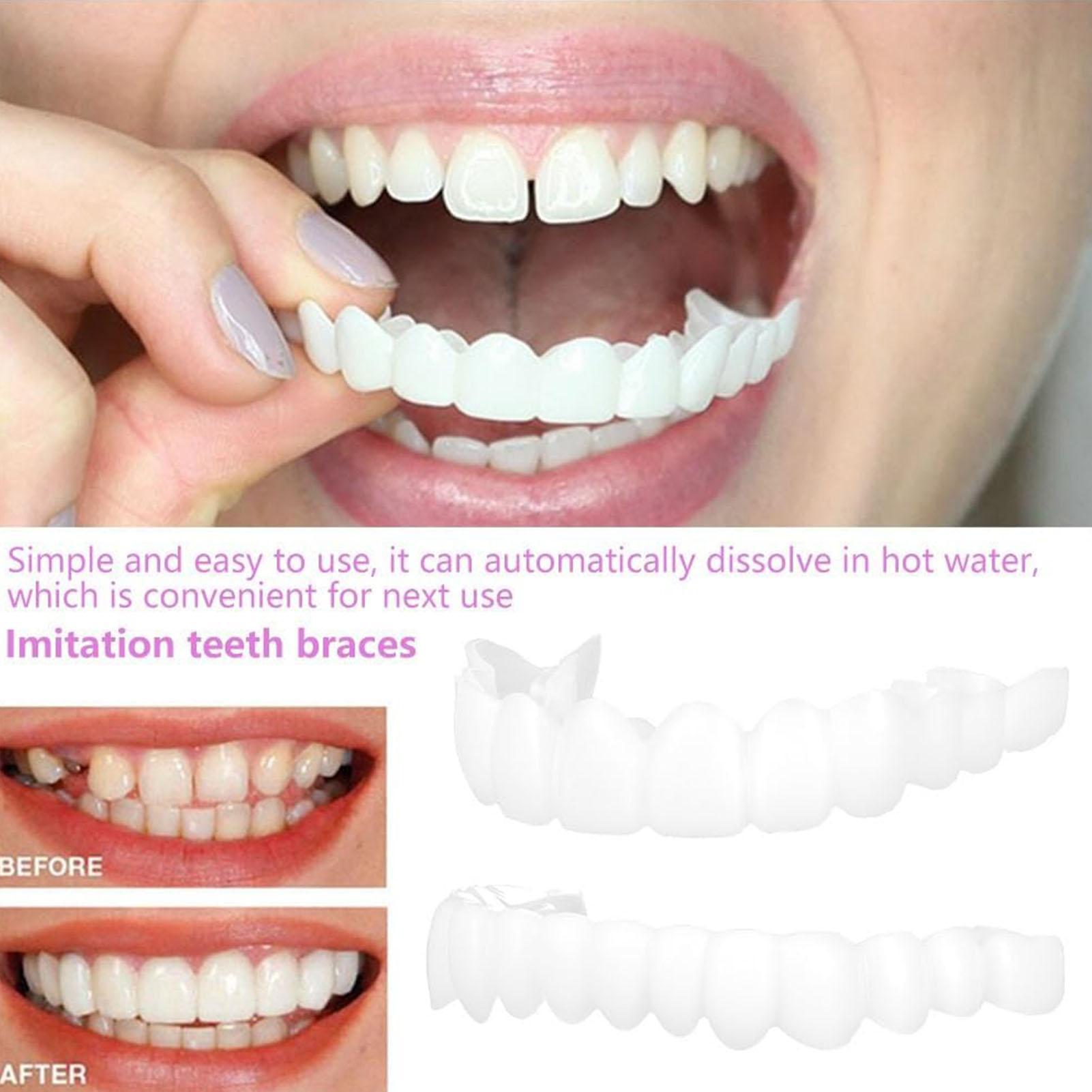 歯科用上下義歯カバー ブライトベニア 快適フィット フレック - Teeth Whitening For Braces のレビューと価格