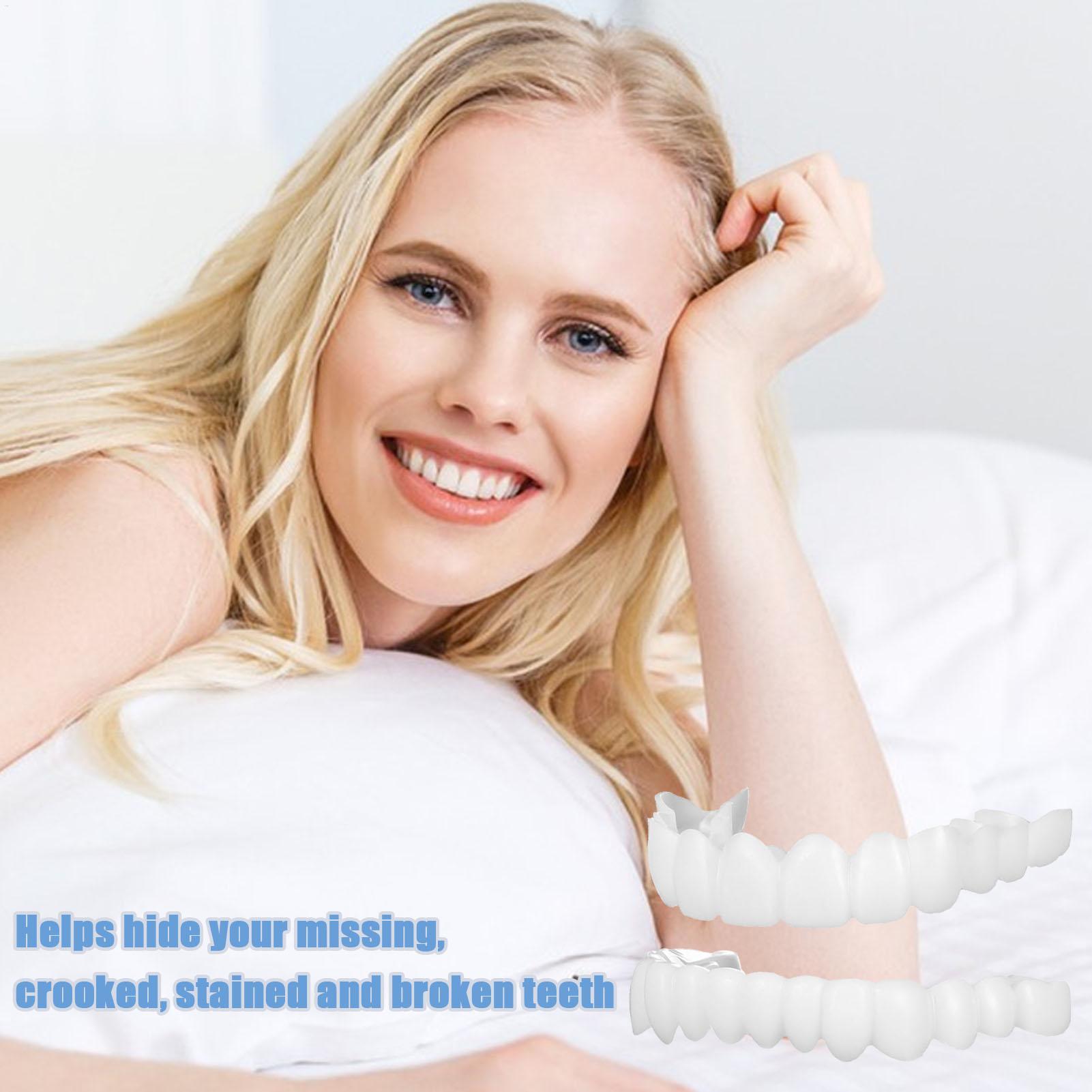 歯科用上下義歯カバー ブライトベニア 快適フィット フレック - Teeth Whitening For Braces のレビューと価格