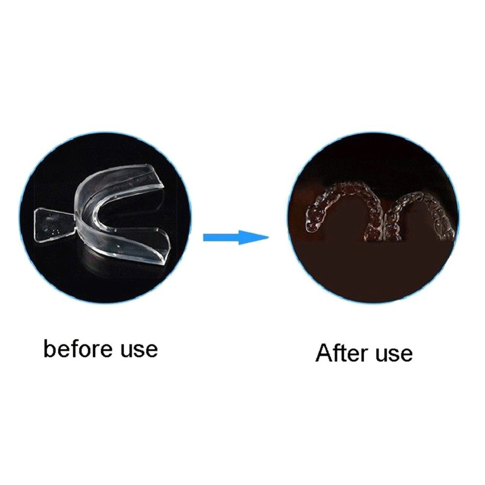 2/4 個ソフト歯矯正ブレースセット交換用歯マウスガードプロ - Teeth Whitening For Trays のレビューと価格