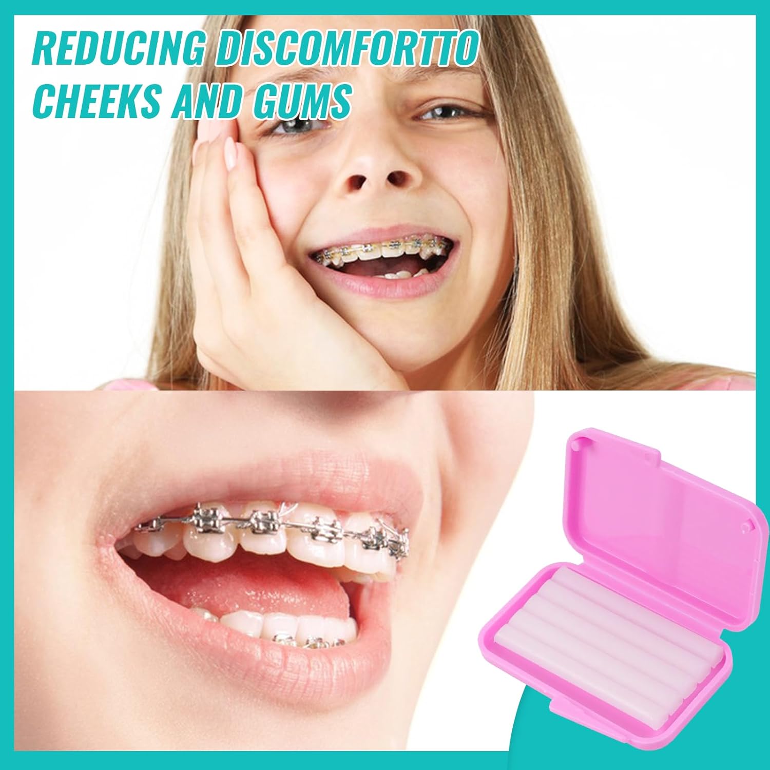 10 ボックス歯科矯正リリーフワックスブレース用歯茎刺激歯の - Teeth Whitening For Braces のレビューと価格