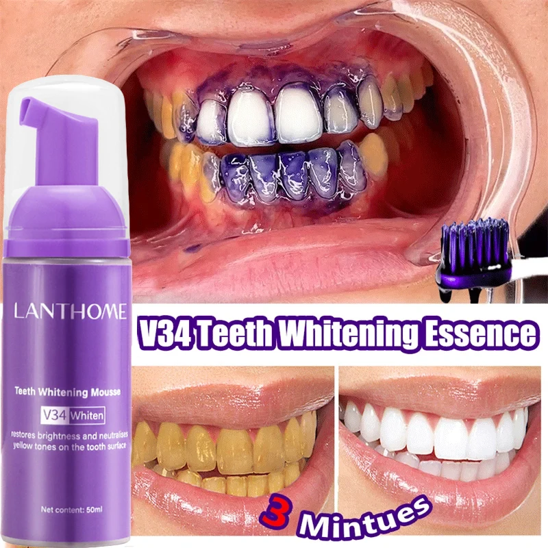 V34 ホワイトニングムース歯磨き粉 歯垢除去 ステイン除去 - Teeth Whitening Xylitol のレビューと価格