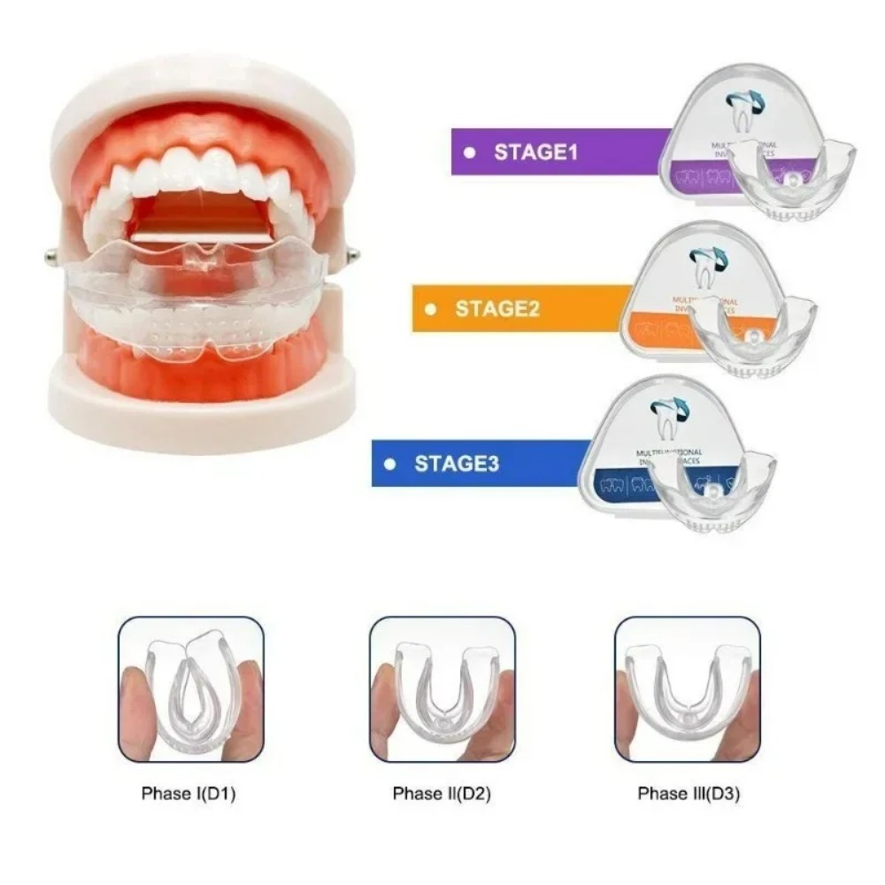 歯列矯正ブレースストレートナー歯列矯正器具歯トレーナーアライ - Teeth Whitening For Braces のレビューと価格