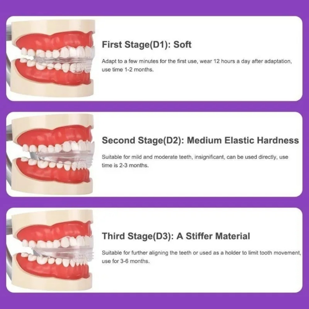 歯列矯正ブレースストレートナー歯列矯正器具歯トレーナーアライ - Teeth Whitening For Braces のレビューと価格