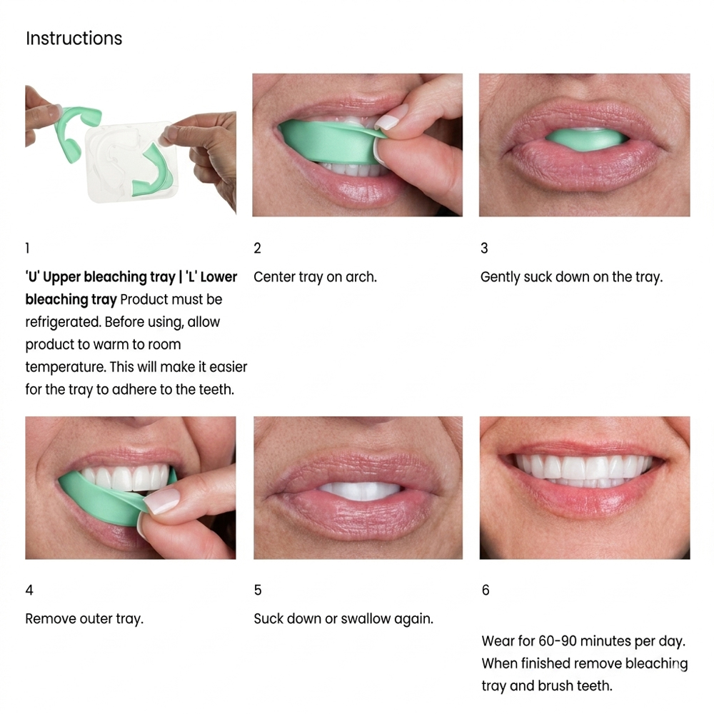 オパレスセンスGO 6%過酸化水素入りプレフィルド歯のホワイ - Teeth Whitening Opalescence Go のレビューと価格